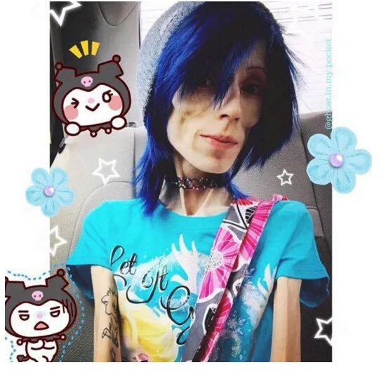 世界上最瘦的人排行榜,蒂塔万提斯排名第五(性感16寸腰)