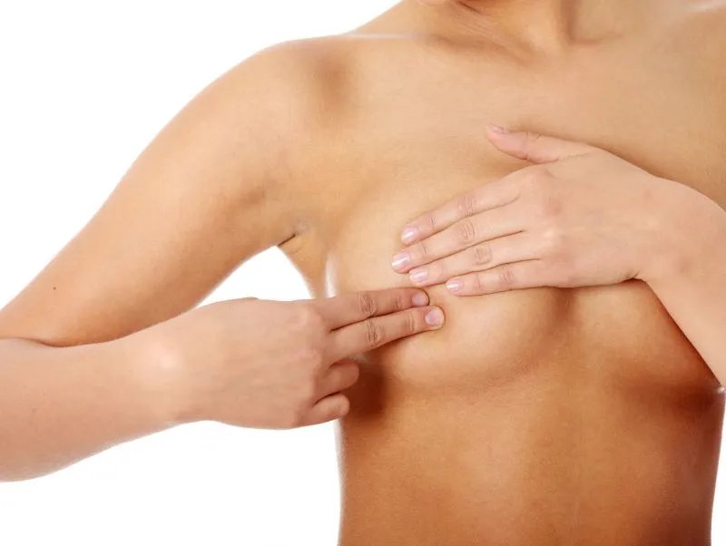 乳房整形前后对比