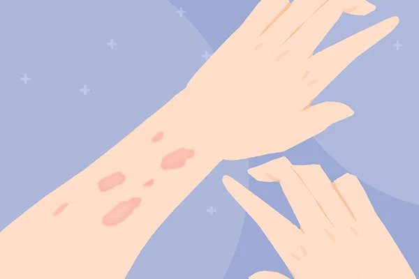 土荆皮的功效与作用