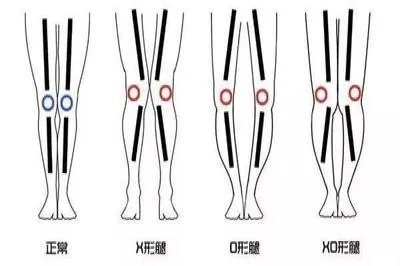 双腿并拢正常腿型图片