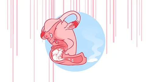 妇科支原体感染的症状有哪些