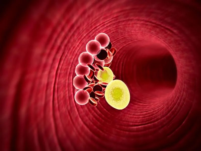 怎么降低总胆固醇