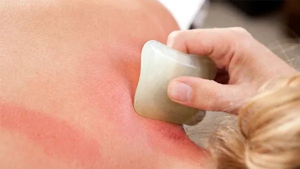 刮痧后注意事项