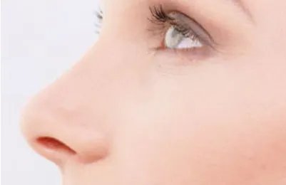 重庆时光整形美容医院隆鼻怎么样?费用大概多少钱?