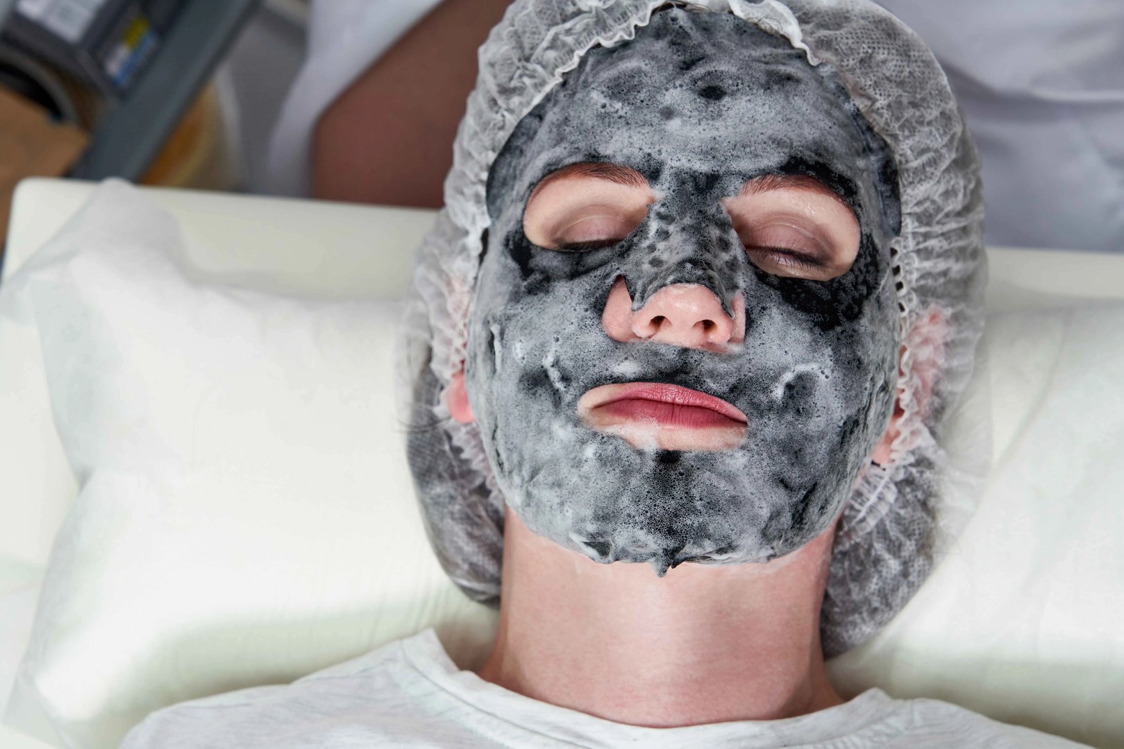 怎么才能去黑头粉刺