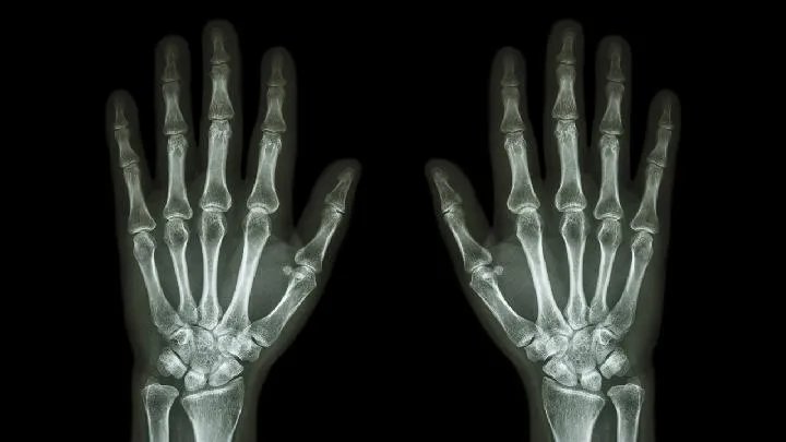 血源性骨髓炎病理特点