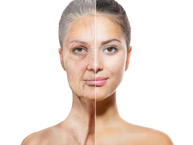 小切口除皱有什么好处