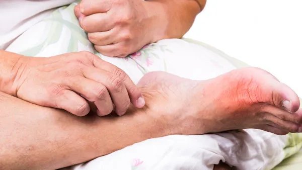 手脚冰冷怎么调理