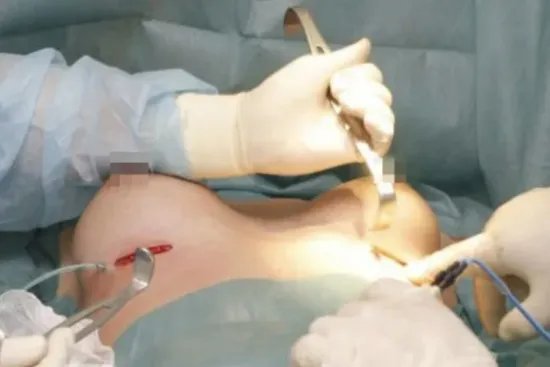 最有效丰胸方法图解