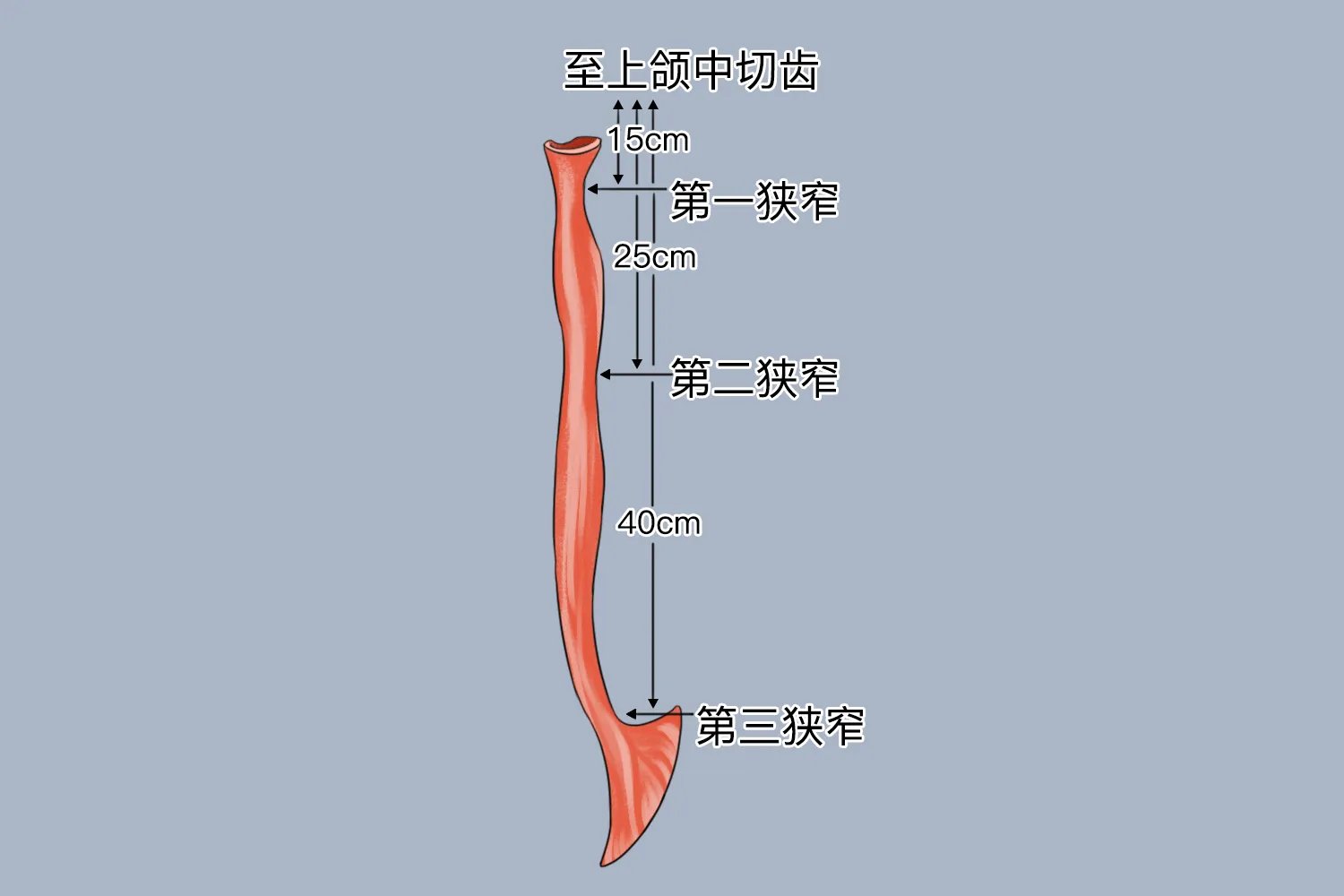 食管癌的好发部位