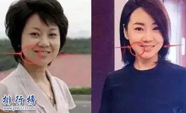 娱乐圈十大承认整容明星，最后一个让人唏嘘不已