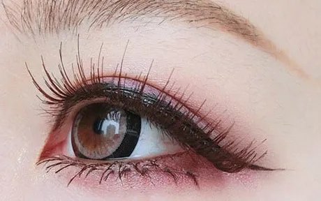 压双眼皮怎么做的