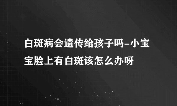 白斑病会遗传给孩子吗-小宝宝脸上有白斑该怎么办呀