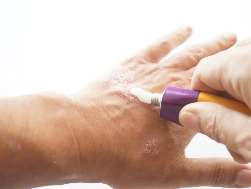 硼酸软膏的功效与作用