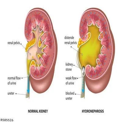 泌乳素高的危害有哪些 揭秘泌乳素过高对人体的危害