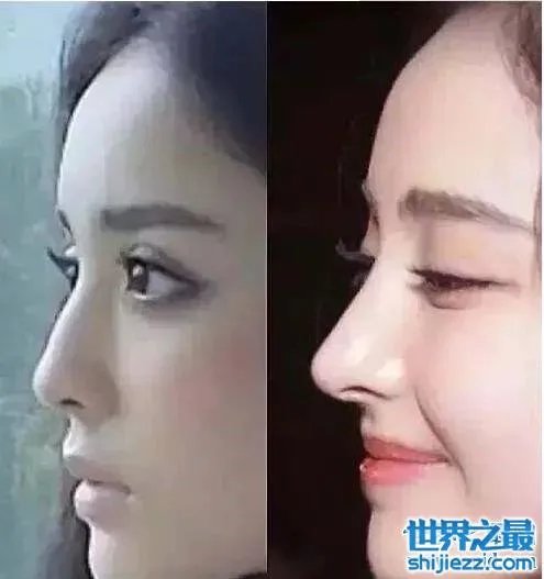 古力娜扎整容前后照片，变化之大让人惊呆 