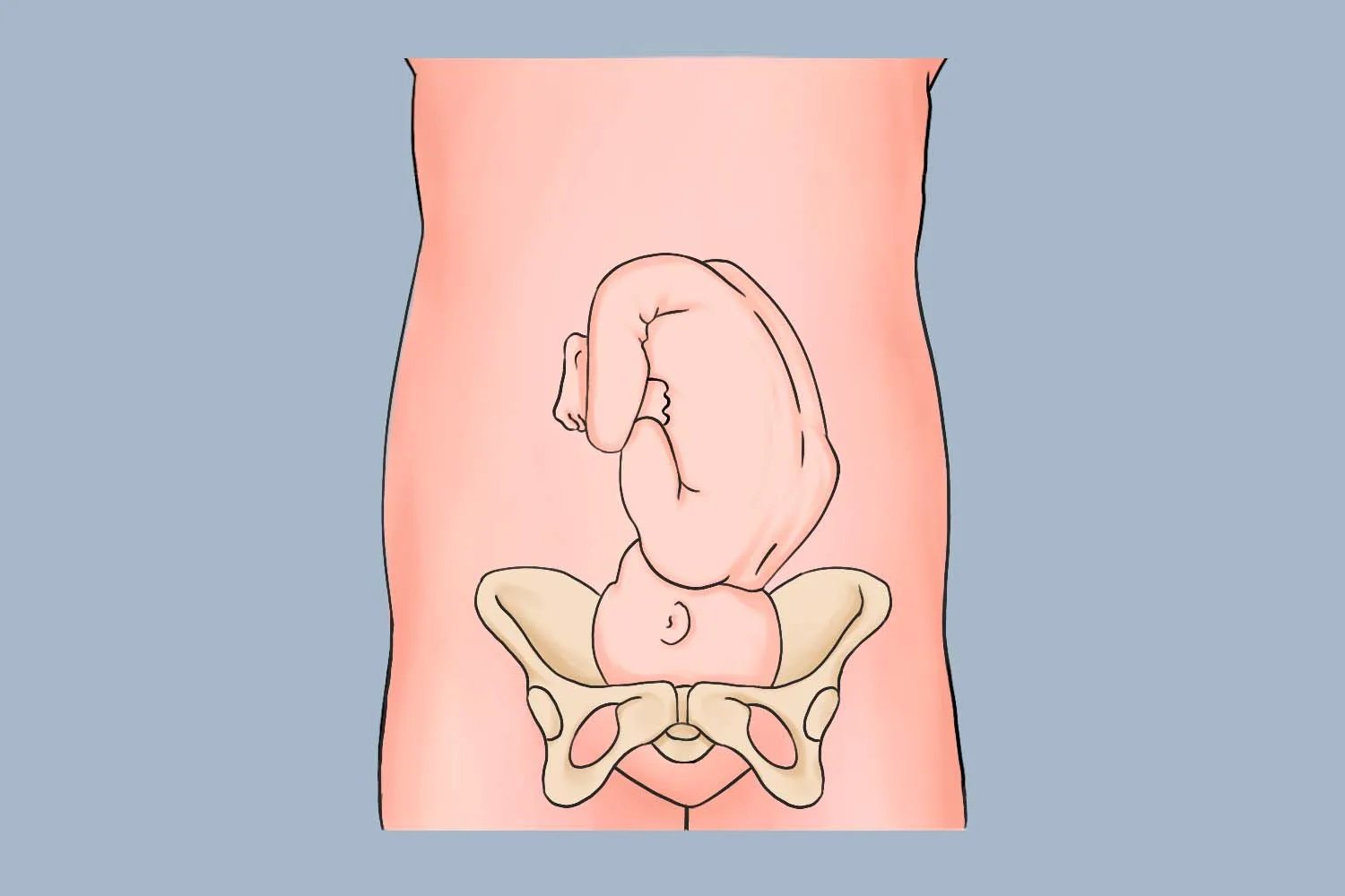 最适合顺产的胎位图