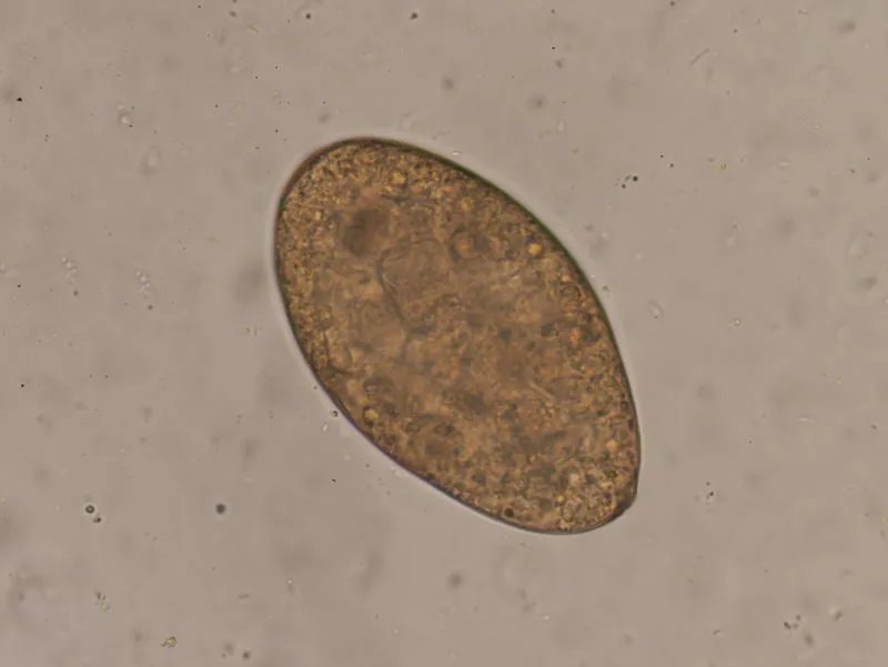 牛带绦虫是什么