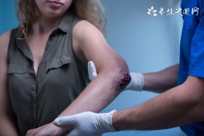 安乐死是什么药，是一种能让人没有痛苦死去的药