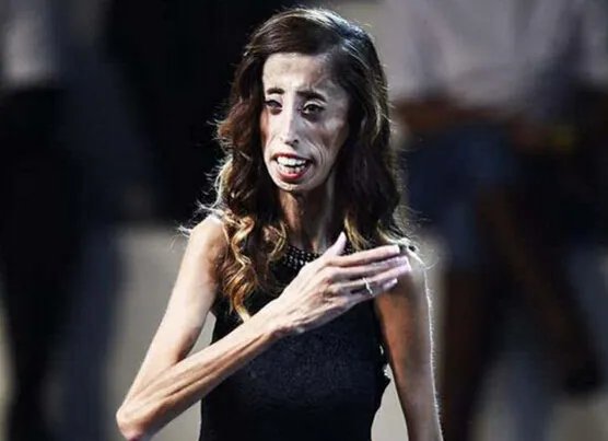 世界上最瘦的人排行榜,蒂塔万提斯排名第五(性感16寸腰)