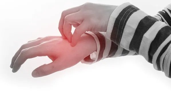 手上长水泡很痒怎么办