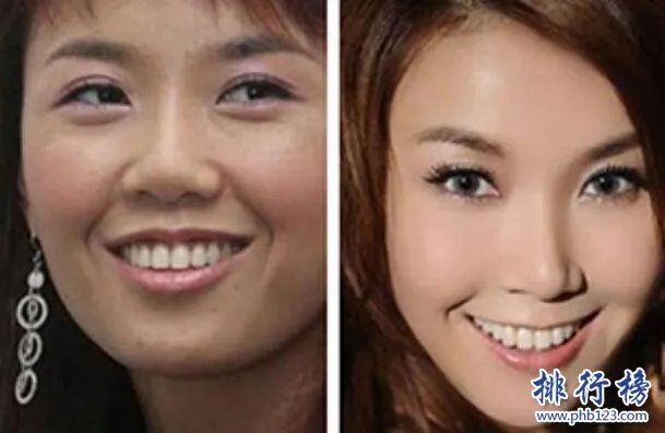 娱乐圈十大承认整容明星，最后一个让人唏嘘不已