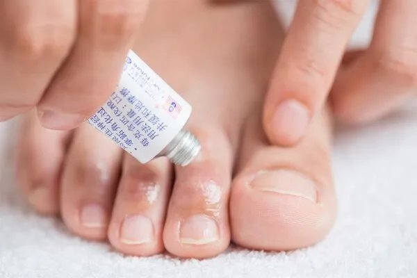 皮康王复方酮康唑软膏多少钱一支