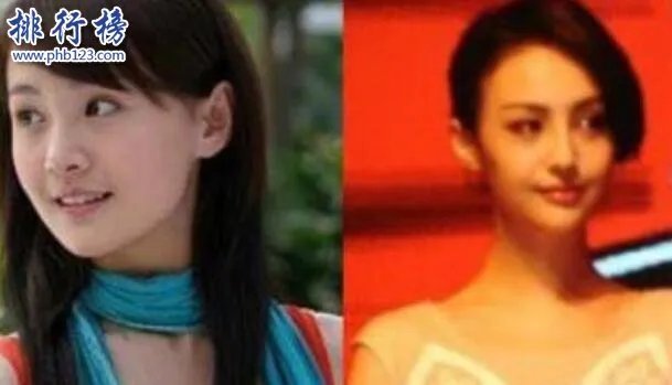 娱乐圈十大承认整容明星，最后一个让人唏嘘不已