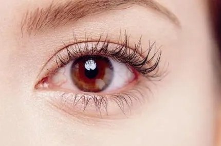 北京埋线双眼皮价格多少