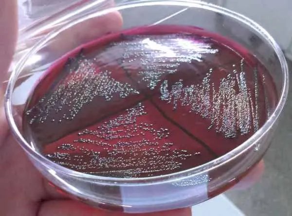 配制培养基的步骤?