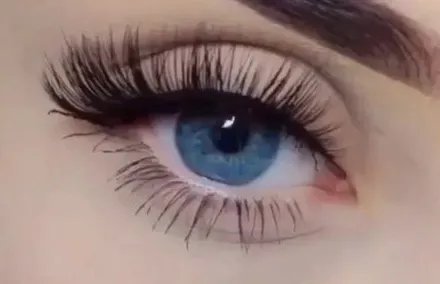 韩式无痕双眼皮的危害大吗