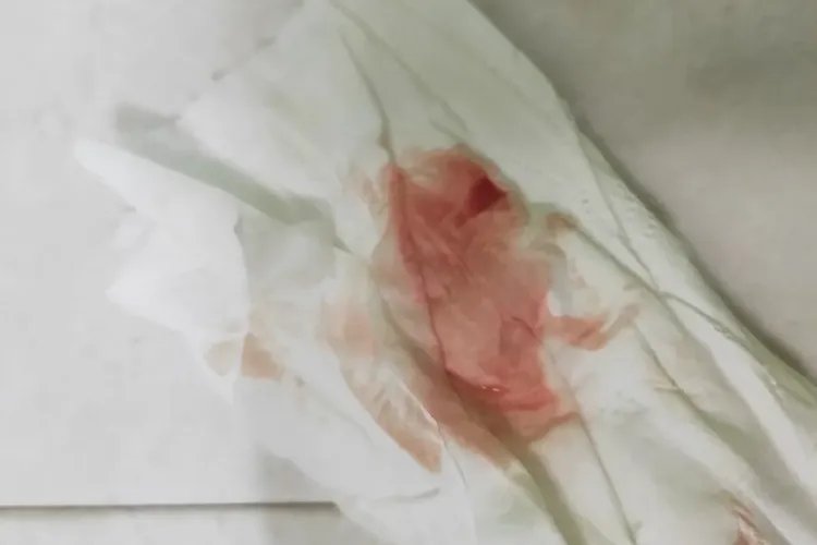 移植着床出血正常图片