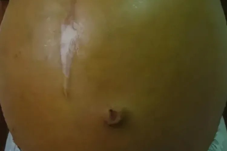 肝不好都有什么样的症状和反应