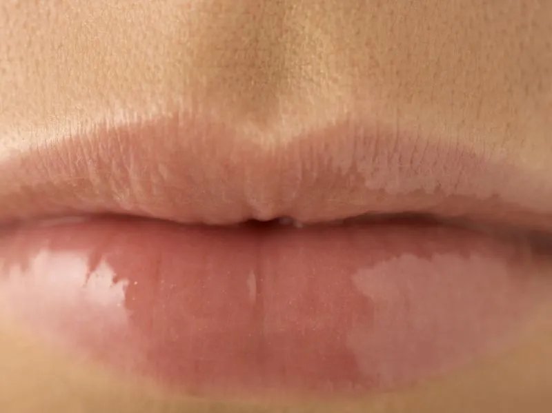 唇部脱毛有哪些方法