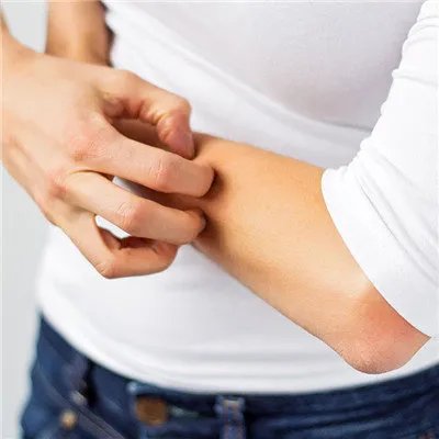 干燥综合症的症状?