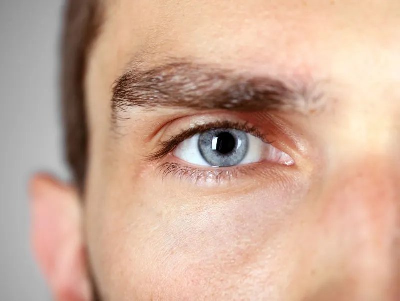 眼睛炫光是什么症状