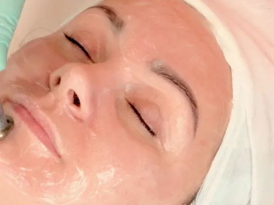 去红血丝的有效方法有哪些