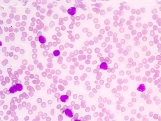 结核菌培养的作用