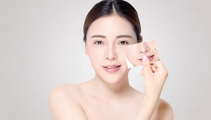 欧莱雅适合什么年龄 欧莱雅适合多大年龄用