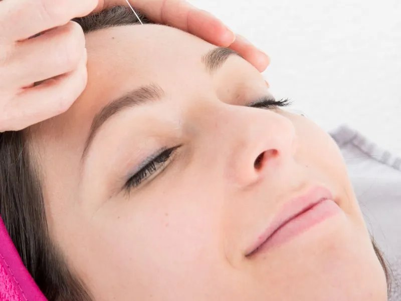 无痕除皱术的方法