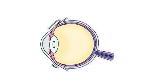 眼睑震颤怎么办