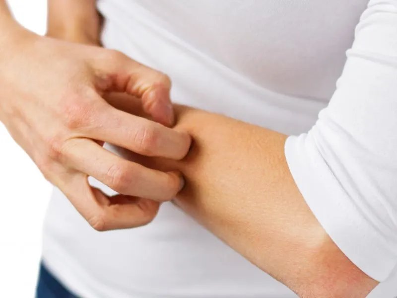 皮炎平价格是多少