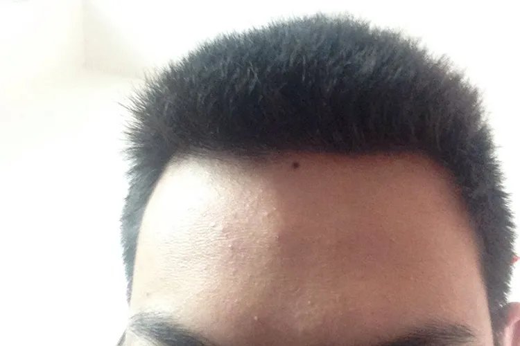 方颅成年后图片