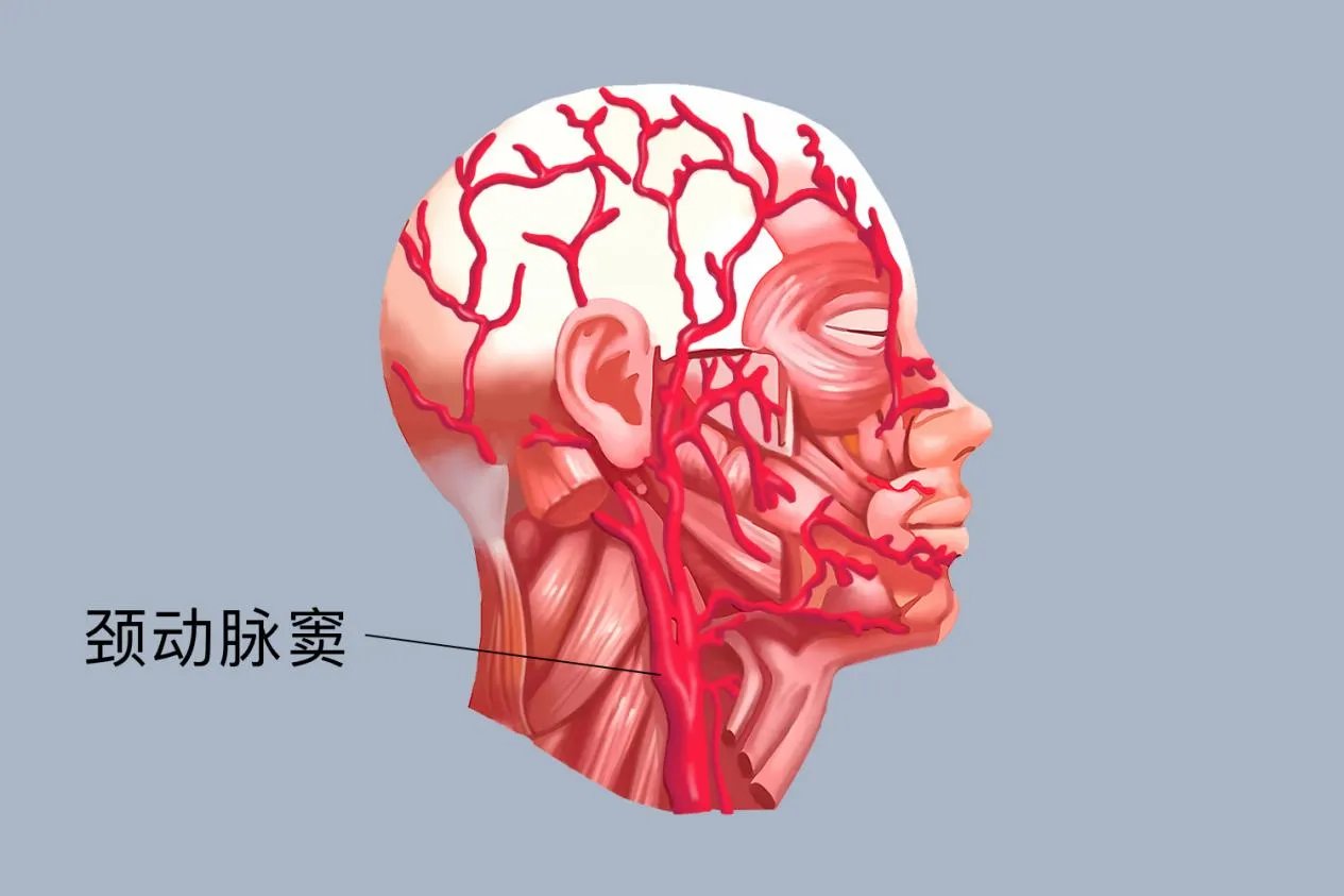 颈动脉窦的准确位置图
