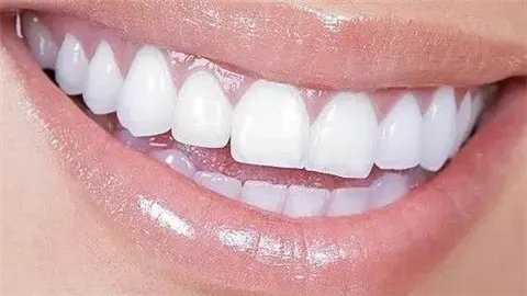 做一颗烤瓷牙需要多少钱