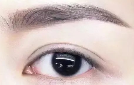 韩式割双眼皮需要多少钱