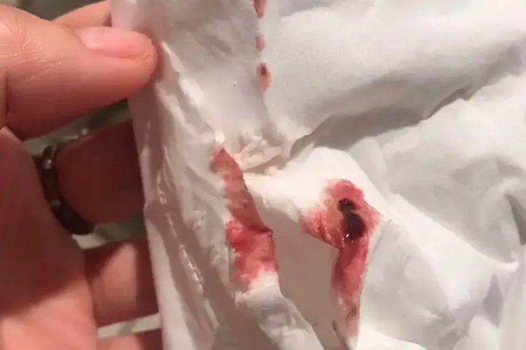 孕酮低会出现什么样的症状