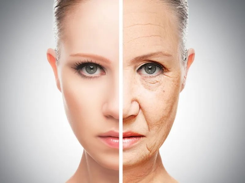 韩式除皱手术注意事项