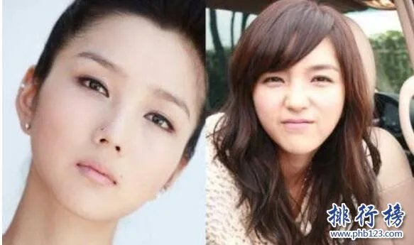 娱乐圈十大承认整容明星，最后一个让人唏嘘不已