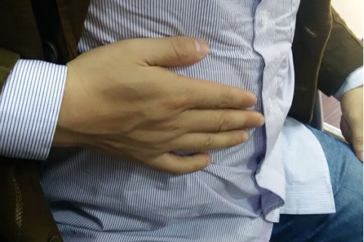 肝囊肿严重吗